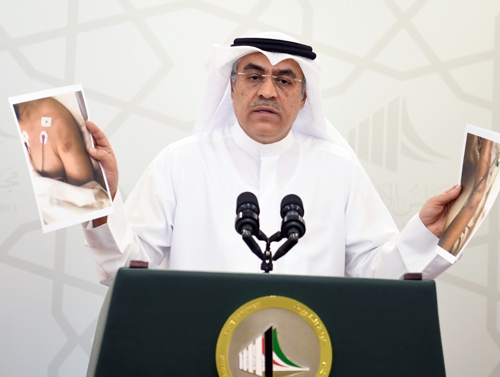 خالد العنزي يطالب وزير الداخلية بإجراءات فورية وإيقاف المتورطين في قضية تعذيب عبدالله طامي